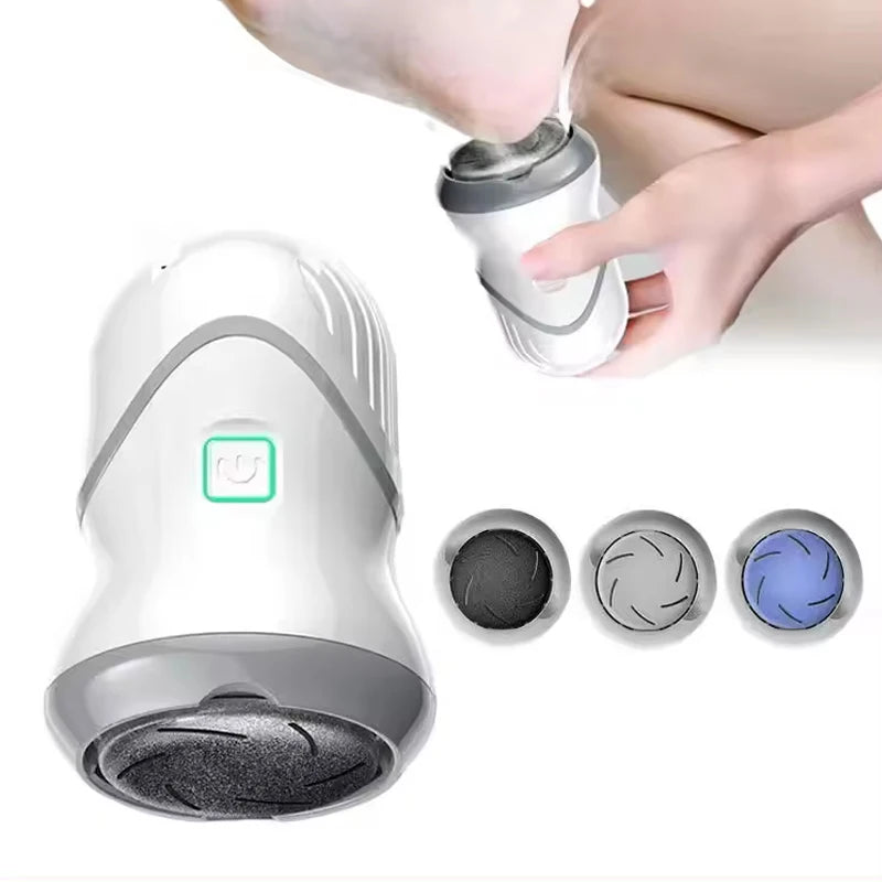 Electric Vacuum Callus Remover — product photo 1