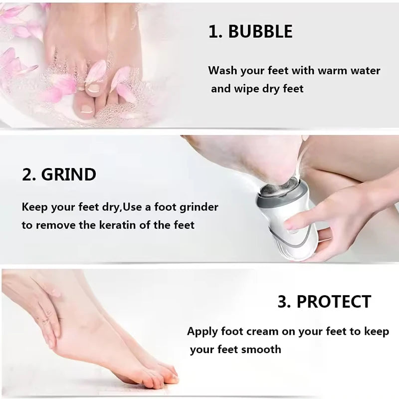 Electric Vacuum Callus Remover — product photo 3